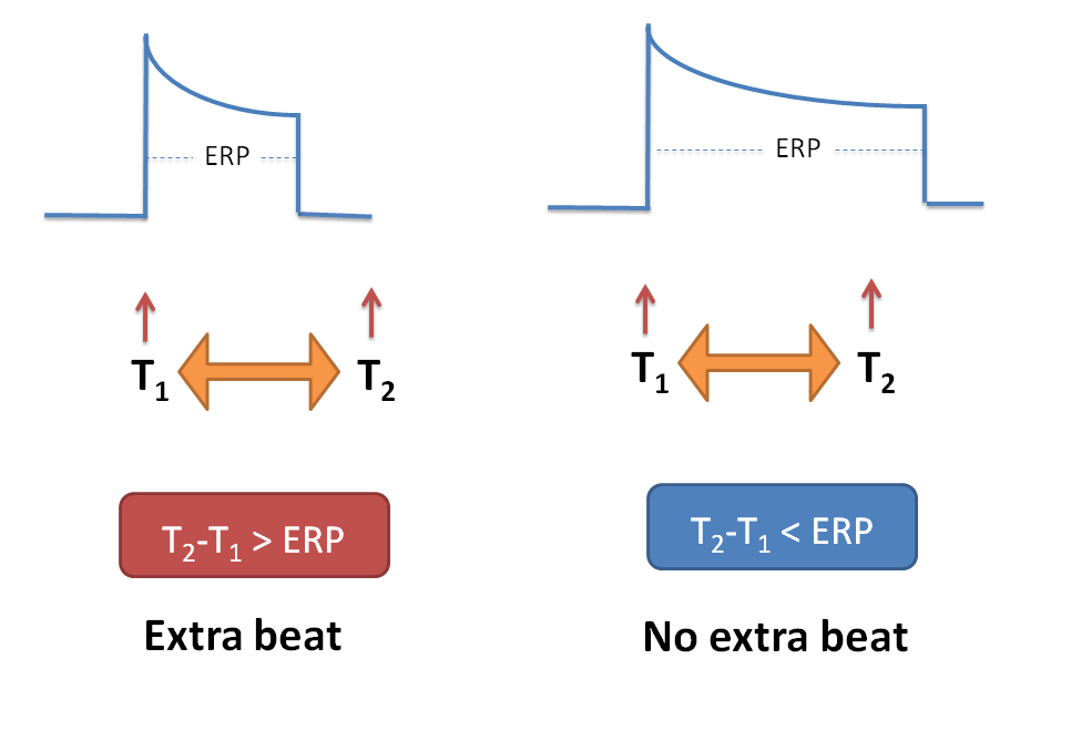 No extra heart beat can be observed if impulse reaches after ERP