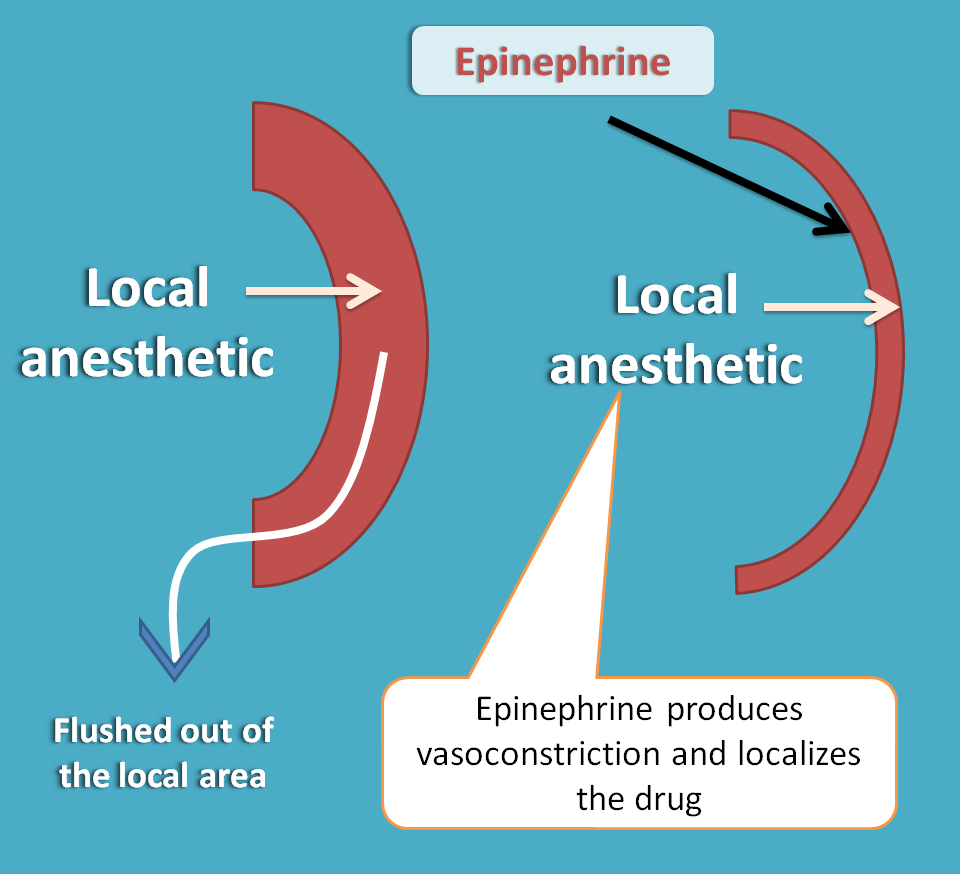 local vasoconstriction by epinephrine