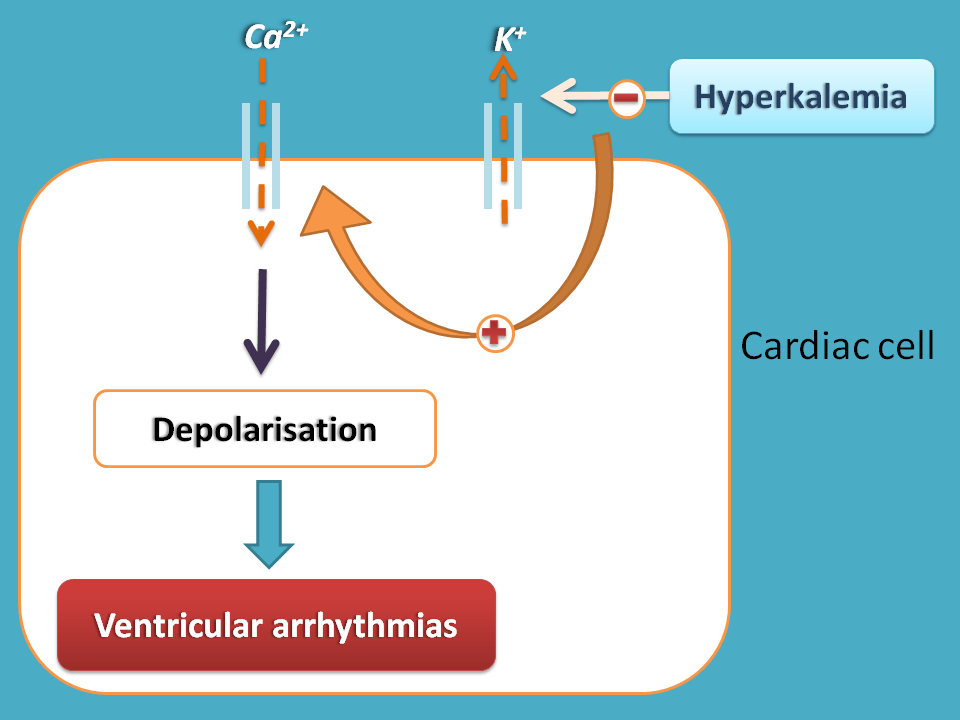 succinylcholine induced arrhythmia